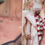 7 फरवरी को हुई शादी, 10 फरवरी को प्रियंका चोपड़ा की भाभी के शरीर पर पड़ गए छाले: सामने आया चौंकाने वाला वीडियो, फैंस से मांगे इलाज के सुझाव