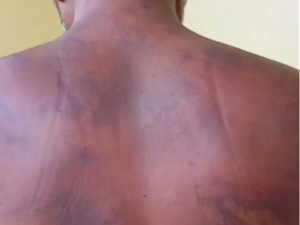 Read more about the article शहपुरा पुलिस पर युवक की कस्टडी में बेरहमी से पिटाई का आरोप, हालत बिगड़ी तो जेल से छोड़ा – CM से जांच की मांग