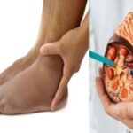 बार-बार पेशाब आना या शरीर में सूजन? किडनी फेल होने के ये हो सकते हैं संकेत